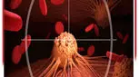 یک واکسن درمانی HPV می تواند ضایعات پیش سرطانی دهانه رحم را از بین ببرد