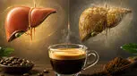 قهوه اسپرسو برای کبد چرب خوبه؟ بررسی فواید، مقدار مصرف و بهترین زمان نوشیدن
