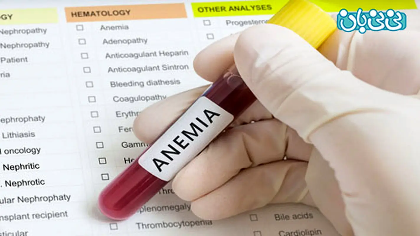 علایم کم خونی در نوزادان