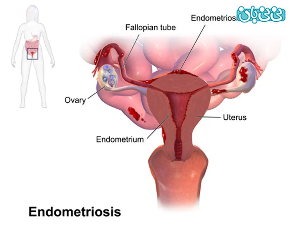 برای یک بارداری سالم بخوانید