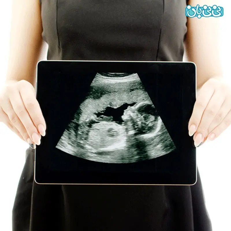 زمان انجام سونوگرافی