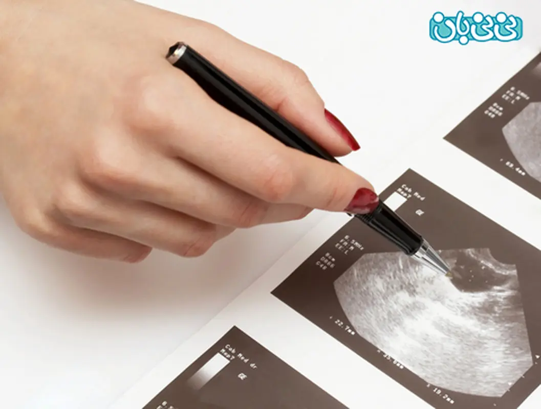 سونوگرافی دو بعدی یا استاندارد