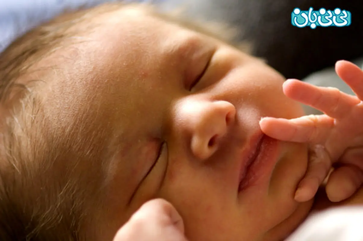 علت خفگی در نوزادان (2)
