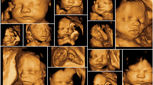 سونوگرافی سه بعدی، آیا برای جنین ضرر دارد؟