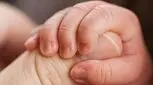 کبودی ناخن نوزاد، نشانه کدام بیماریست؟