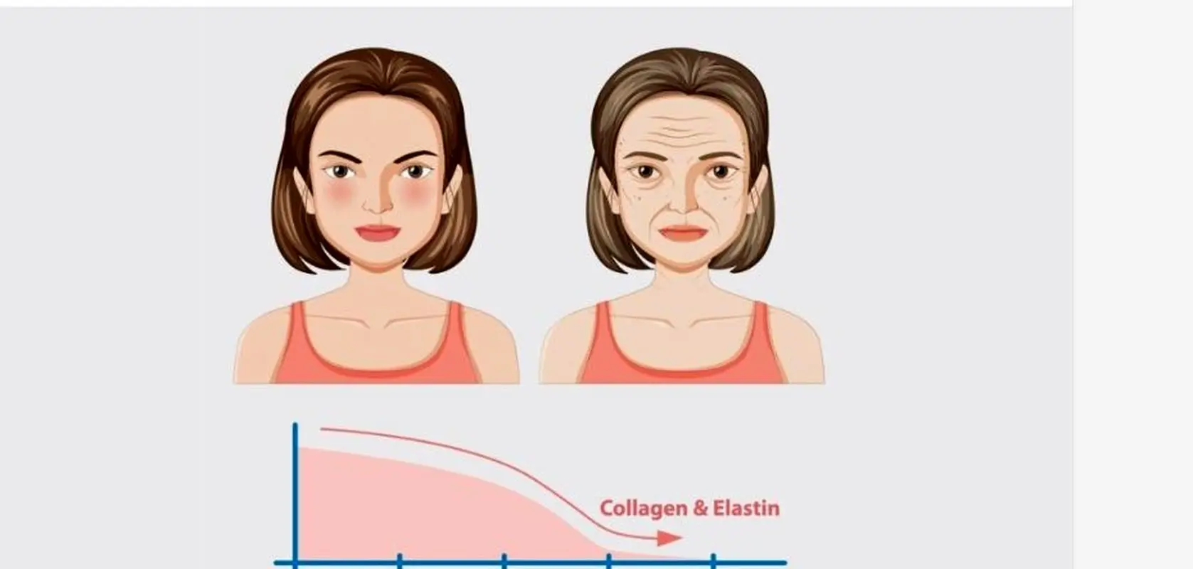 ۴ نوع پیری پوست کدام است؟ 