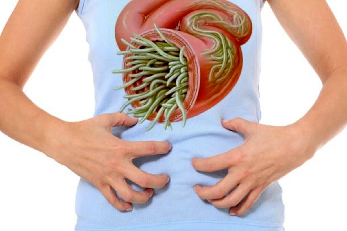 با این علائم، احتمالا انگل دارید