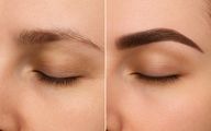 فیبروز ابرو چیست؟ هزینه‌، مزایا و معایب آن