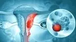 سرطان رحم و hpv