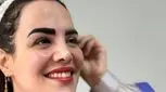 معرفی کلینیک معتبر برای کاشت ابرو