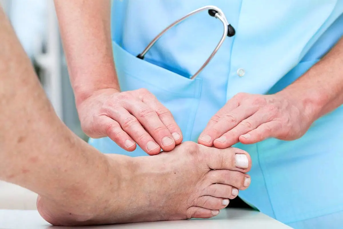 از اسید اوریک چه میدانید؟/ یک اشتباه رایج درباره لبنیات پرچرب