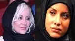 تغییر چهره جنجالی شراره رخام با جراحی های زیبایی/ هر روز پلنگ تر از دیروز