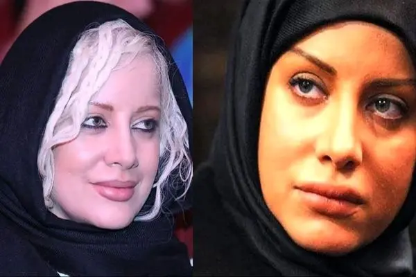 تغییر چهره جنجالی شراره رخام با جراحی های زیبایی/ هر روز پلنگ تر از دیروز