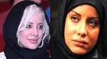 تغییر چهره جنجالی شراره رخام با جراحی های زیبایی/ هر روز پلنگ تر از دیروز