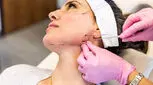خارج سازی نخ‌های لیفت عفونت کرده چگونه انجام می‌شود؟
