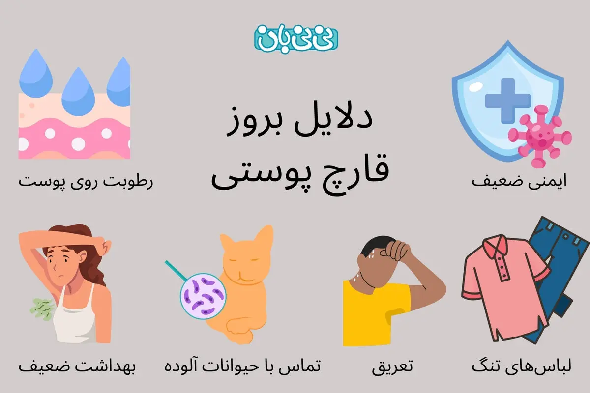 5 علامت قارچ پوستی | روش‌های درمان خانگی و دارویی