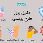 5 علامت قارچ پوستی | روش‌های درمان خانگی و دارویی