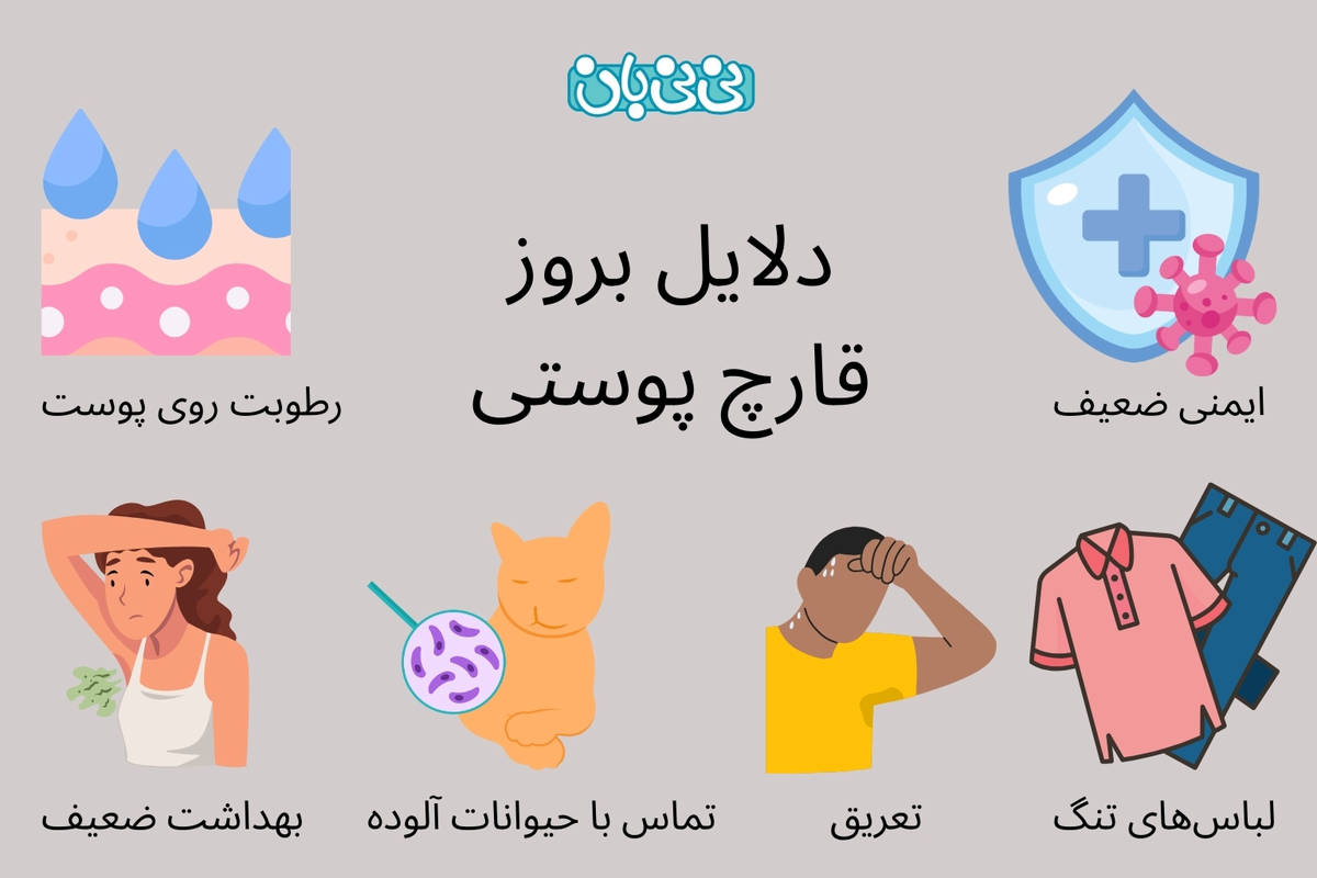 5 علامت قارچ پوستی | روش‌های درمان خانگی و دارویی