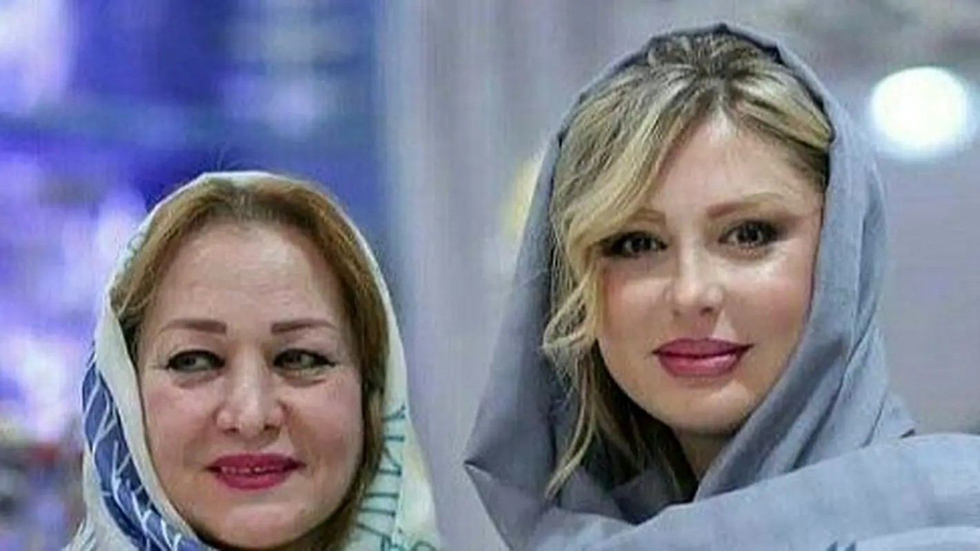 عکس جنجالی لحظه زایمان بازیگر معروف ایرانی با آرایش غلیظ در اتاق عمل!