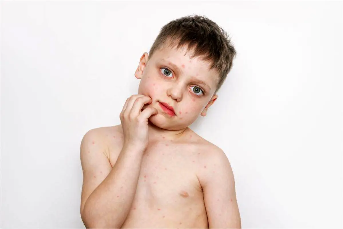 آیا این ویروس وحشی دوباره به ایران برگشته؟