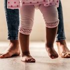 پاهای ضربدری در کودکان، پیشگیری و درمان