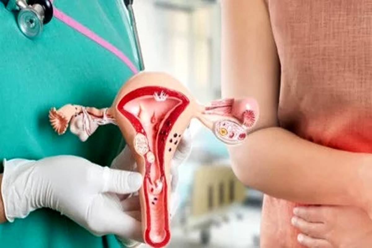 آمار سرطان‌های مرتبط با ویروس اچ‌پی‌وی در حال افزایش است؛ چه کسانی بیشتر تحت خطرند؟
