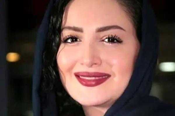 حجاب دختر زیبا و دوست داشتنی شیلا خداداد / انگار اول لپ بوده بعد دست و پا درآورده