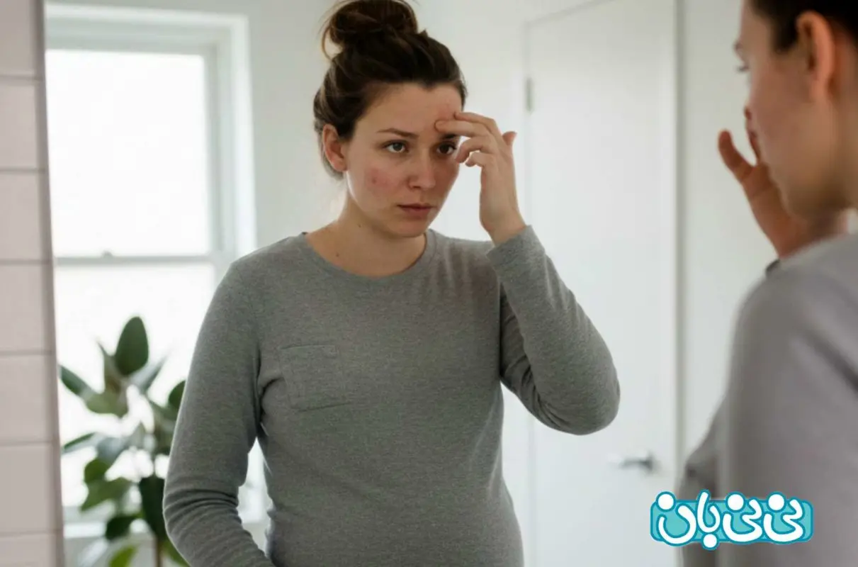 جوش زدن در بارداری و جنسیت جنین، چه ارتباطی دارند؟