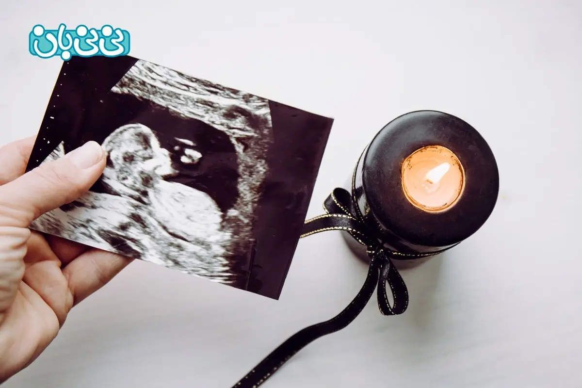 سقط جنین تا چند ماهگی قانونی و مجاز است؟ شرایط صدور مجوز