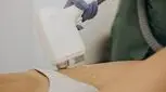 با بلیچینگ بیکینی پوست درخشان‌تری داشته باشید