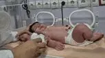 تولد دو نوزاد با اختلاف وزن ۱۱ برابری در بندرعباس!
