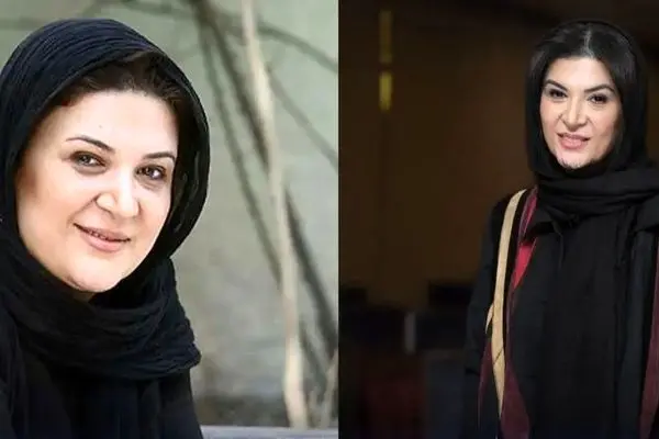 سفر در زمان | تغییر چهره عجیب ریما رامین فر در طول ۱۰ سال