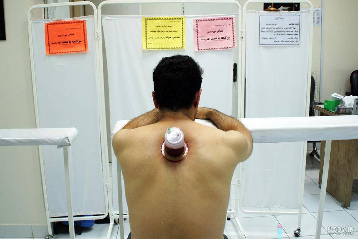 هشدار وزارت بهداشت/ حجامت راه درمان قطعی نیست