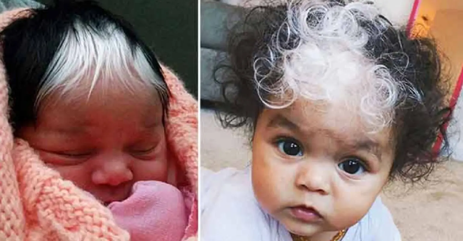 سفید شدن موی نوزاد خطرناکه؟