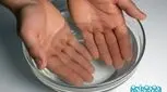درمان میخچه دست _ علت ها، 6 روش‌ خانگی و درمان‌های پزشکی