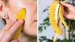 آیا پوست موز تاثیری بر رفع چین و چروک دارد؟

