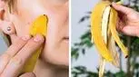 آیا پوست موز تاثیری بر رفع چین و چروک دارد؟

