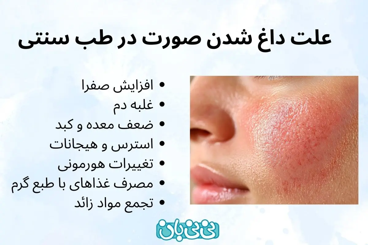 علت داغ شدن صورت در طب سنتی _ 7 علت + روش‌ های درمانی