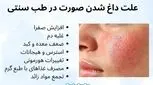 علت داغ شدن صورت در طب سنتی _ 7 علت + روش‌ های درمانی