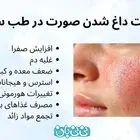علت داغ شدن صورت در طب سنتی _ 7 علت + روش‌ های درمانی