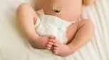 مراقبت از بند ناف نوزاد