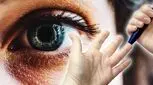 دیابت با بینایی شوخی ندارد؛ کور می‌کند

