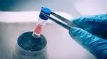 فریز تخمک؛ راهی برای حفظ باروری در سنین بالا