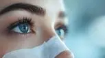 رازهای یک جراحی بینی موفق در سال 1404