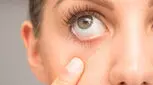 چند تکنیک ساده برای حفظ سلامت چشم 