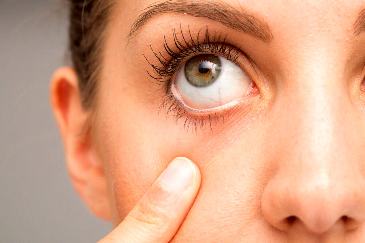 چند تکنیک ساده برای حفظ سلامت چشم 