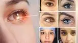 تب جراحی زیبایی تغییر رنگ چشم؛ خطر نابینایی با هزینه‌های میلیونی
