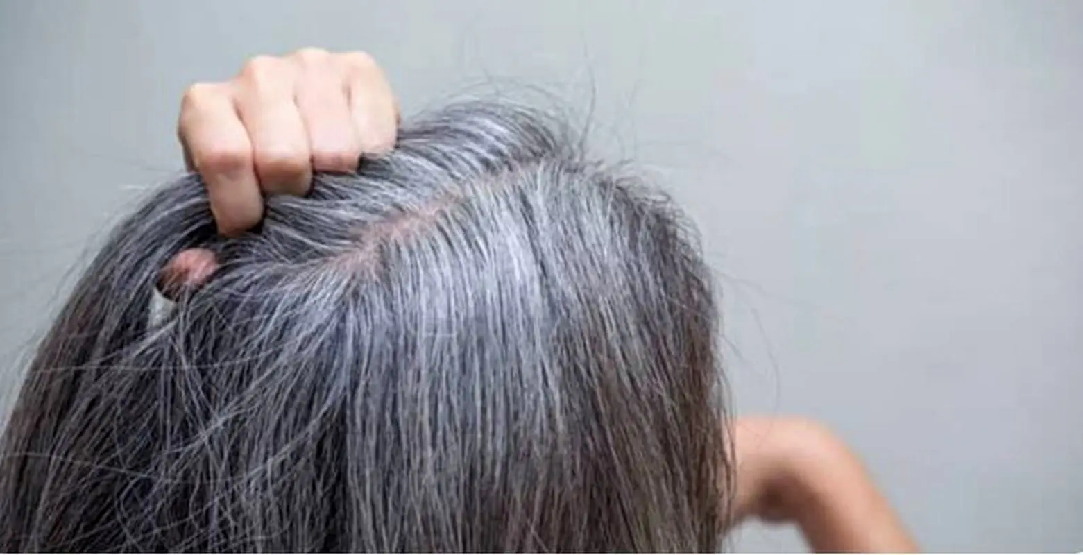 موهای سفید سر را با چه رنگی از بین ببریم؟ 