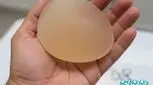 انواع مارک ها و برندهای پروتز سینه _ مقایسه جنس و کیفیت هریک