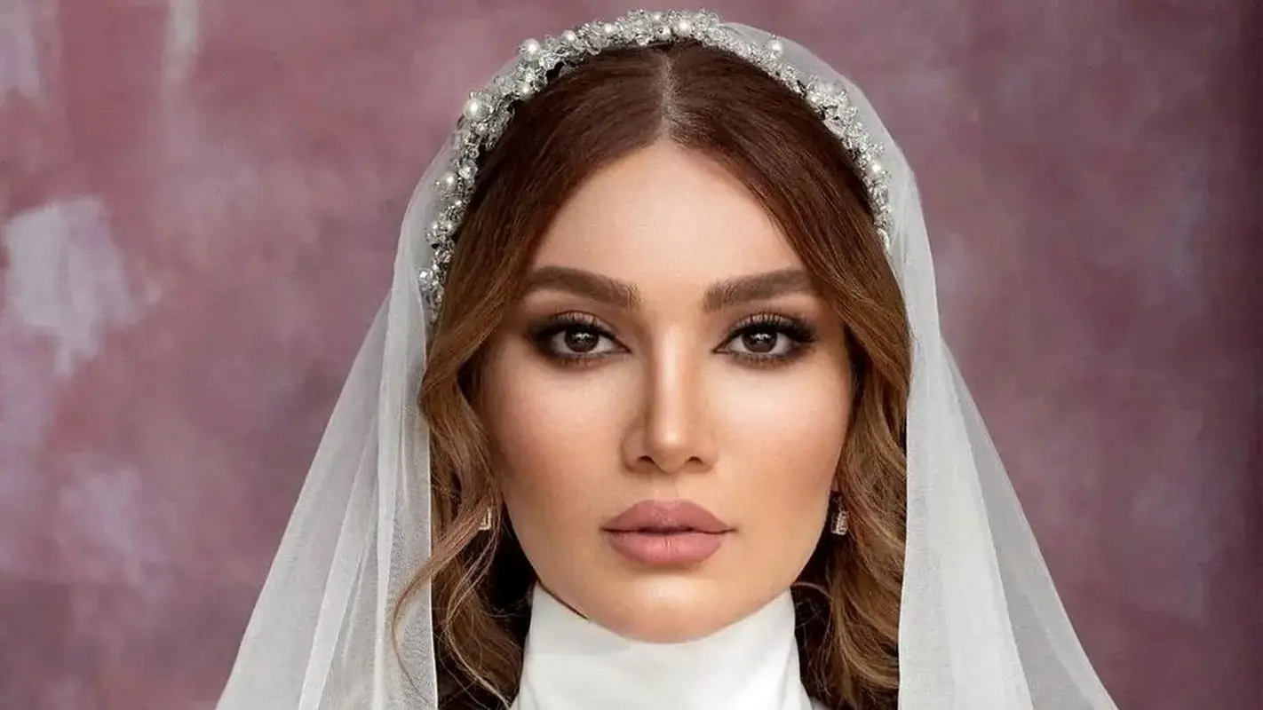 تغییرات چهره متین ستوده قبل و بعد از طلاق / با کامران جوانتر و خوشگلتر شد !